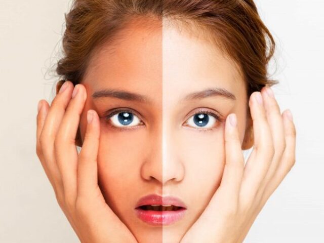 U Indiji je bleđe lepše