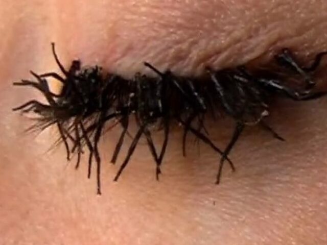 Trepavice od muvinih nogica – Flylashes