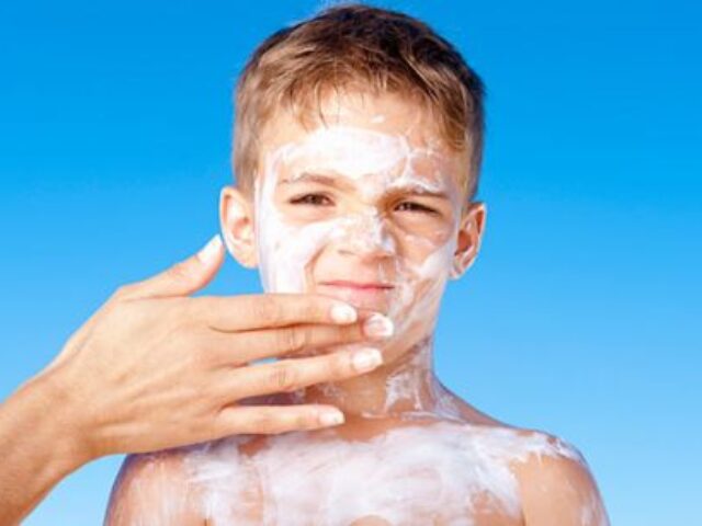 Kako ublažiti bol kože izgorele na Suncu?