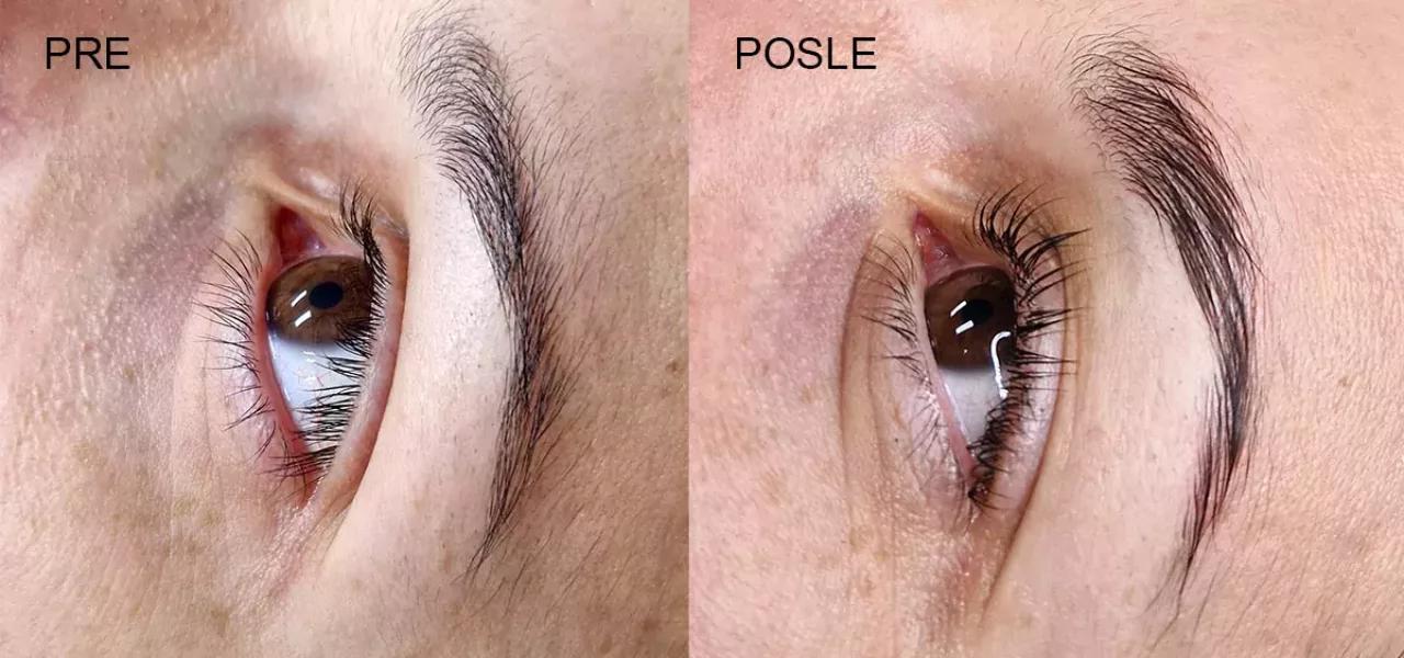podizanje-trepavica-pre-i-posle-tretmana