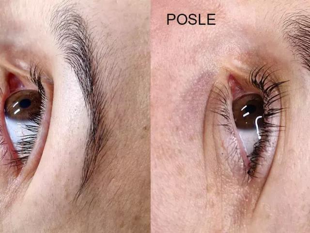 Tretman podizanje trepavica i laminacija obrva – Lash lift & Brow lift